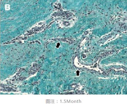 Masquelet技术1.5m组织学