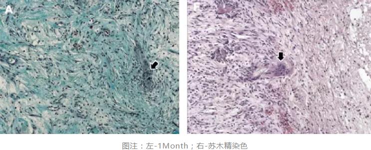 Masquelet技术1m组织学
