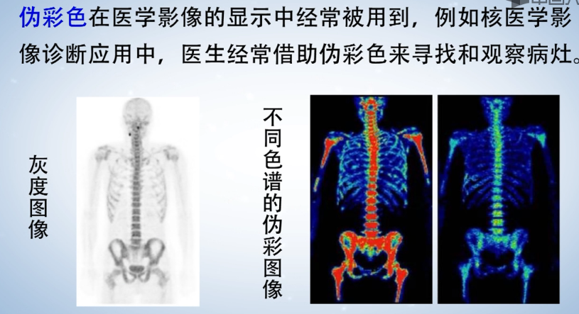 计算机生成了可选文字: 伪 彩 色 在 医 学 影 像 的 显 示 中 经 常 被 用 到 , 例 如 核 学 影 像 诊 断 应 用 中 , 医 生 经 常 借 助 伪 彩 色 来 寻 找 和 观 察 病 灶 。 LAP,' 1 日 像 9 , 9