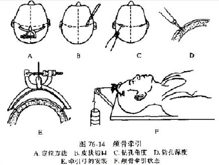 image-20200817135123755