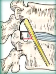 image-20200817170513344