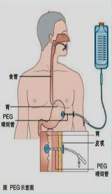 image-20200820051424162