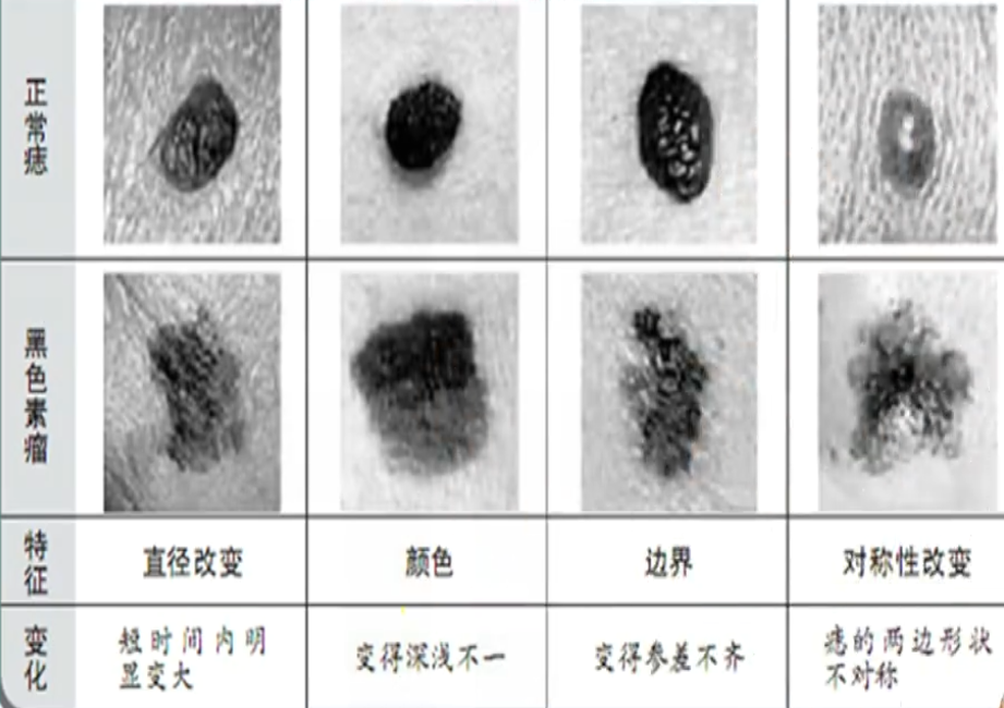 image-20200822155421432