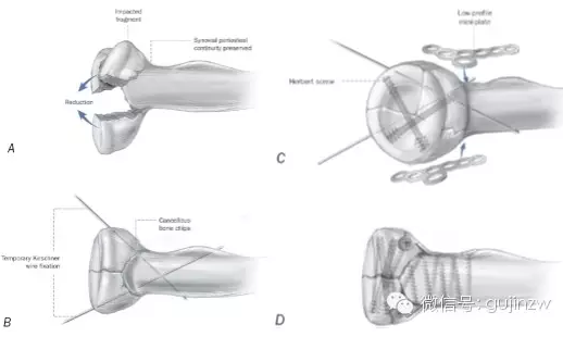 image-20200830112834509