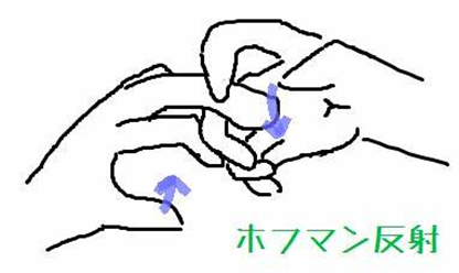 image-20201011135513487