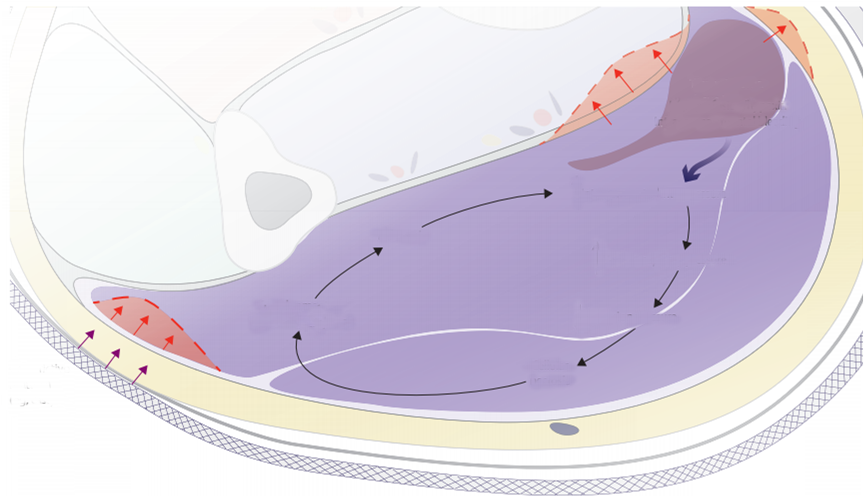 von Keudell , et al. The Lancet. 2015.