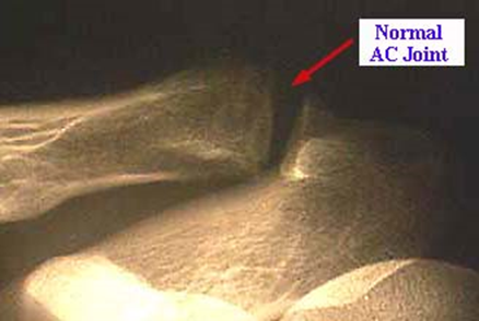 image-20201013195736577