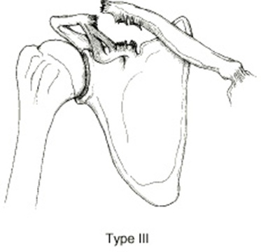 image-20201013200103722