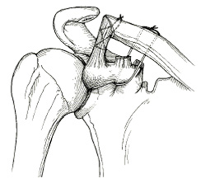 image-20201013200736060