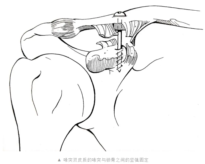 image-20201104185405934