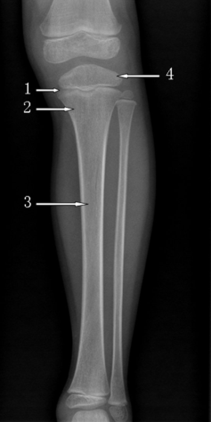image-20201217164304260