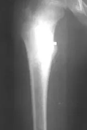 image-20201217170935433