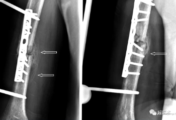 image-20201217180644490