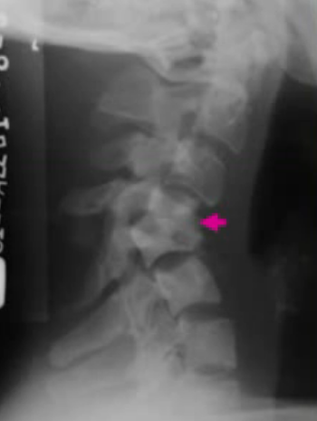 image-20201219140021647