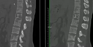 image-20210416145214375