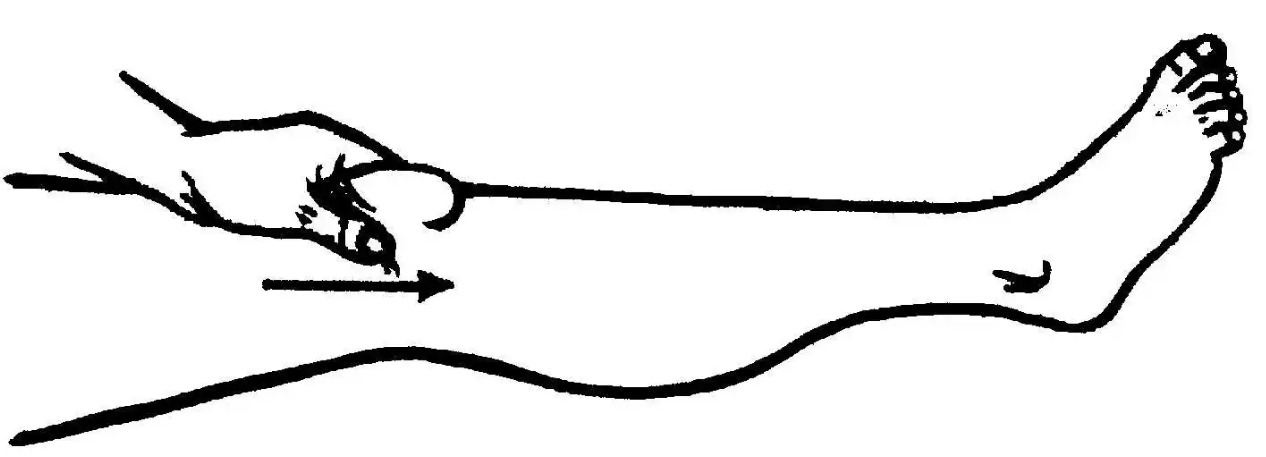 image-20220326063416509