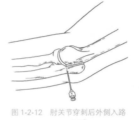 image-20220419070658857