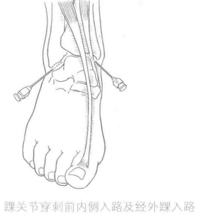 image-20220419070836000