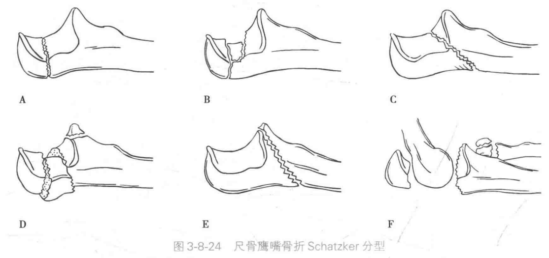 image-20220427110552364