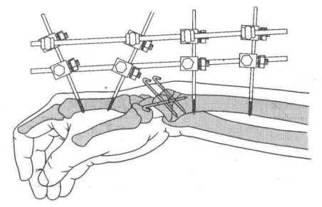image-20220430165950349