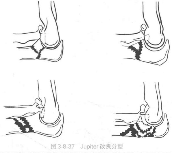 image-20220717052643020