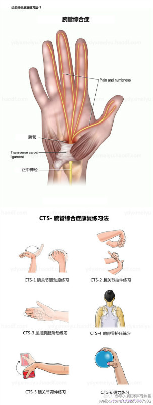 腕管综合症康复练习法