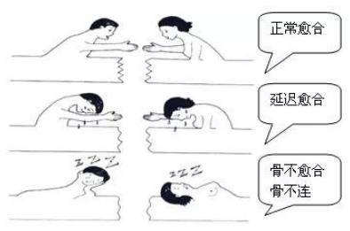 骨折不愈合漫画