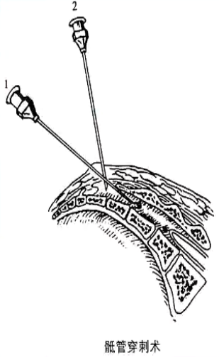 image-20200817171651053